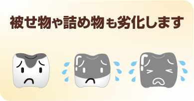 被せ物や詰め物も歯科医院でのチェックが必要